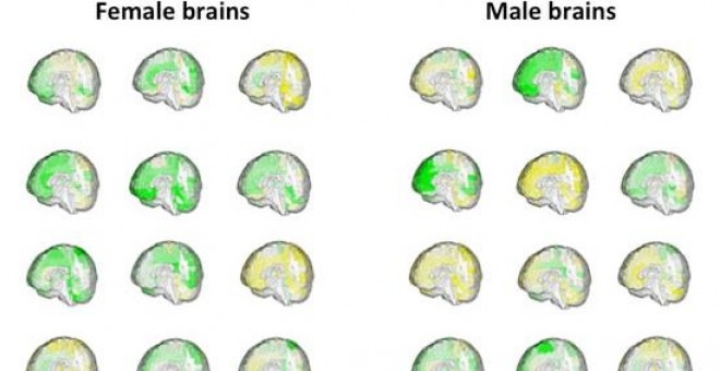 22c2298b87ed3bbb0522f0997ba1a41b El cerebro no entiende de sexos