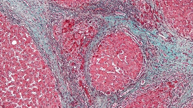 Identifican células que regeneran el tejido hepático tras una lesión