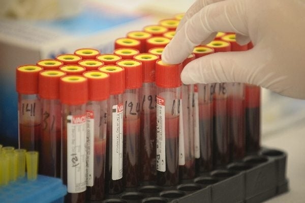 Método japonés detecta 13 tipos de cáncer por medio de prueba sanguínea