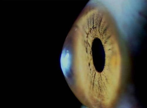 Avanza investigación de terapia celular para tratar la ceguera
