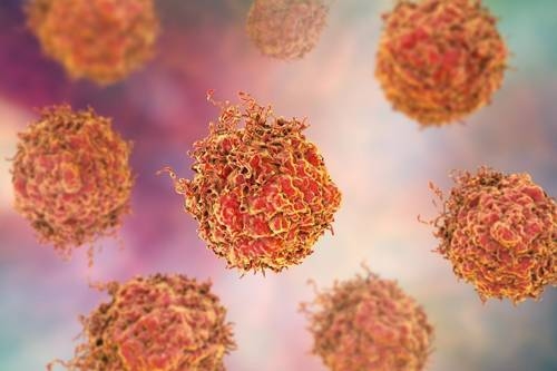 Nueva terapia contra el cáncer de próstata inhibe el crecimiento de células tumorales