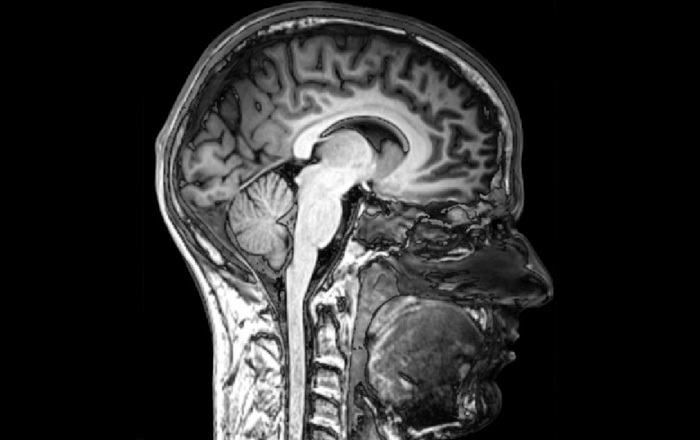 Crean el primer censo de neuronas para comprender mejor el funcionamiento del cerebro