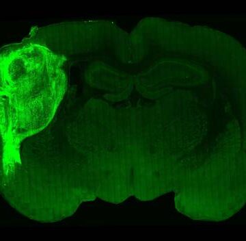 Implantan células cerebrales humanas en ratas; estudian trastornos siquiátricos