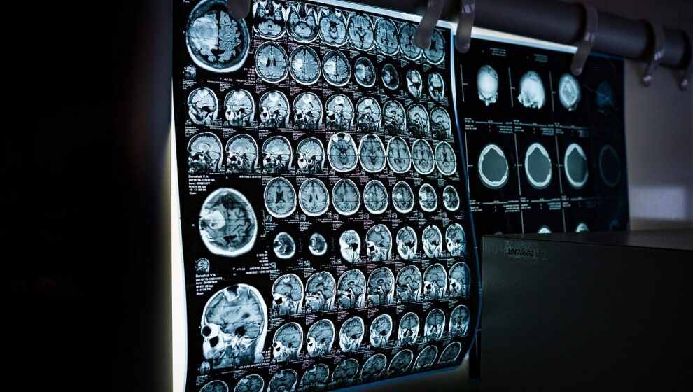 Meditar mejora la plasticidad de tus neuronas