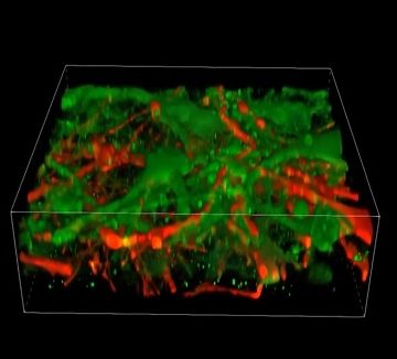 Avance científico: Tejido neuronal impreso en 3D imita al cerebro humano