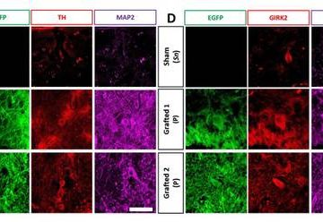 Trasplante de neuronas en monos es efectivo contra el Parkinson