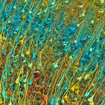 Con muestra del tamaño de medio grano de arroz crean mapa en 3D del cerebro humano
