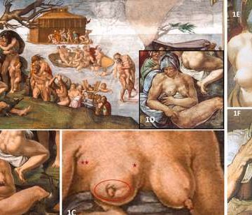 Buscan signos clínicos de trastornos y enfermedades médicas en obras de arte