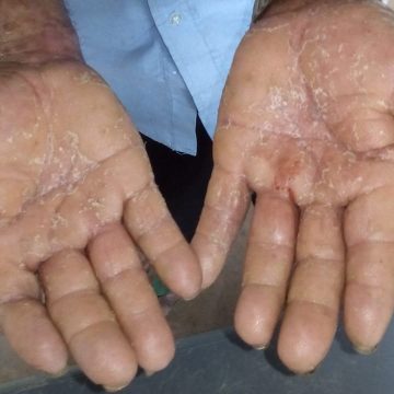El cinismo de no prohibir el glifosato