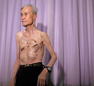 Alcalde de Nagasaki critica política nuclear de la premier japonesa a 81 años de bombardeo