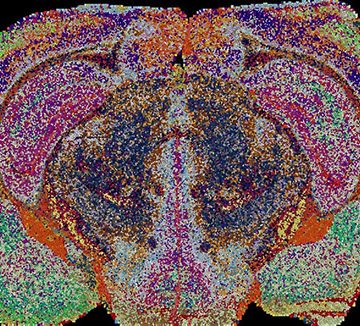 El primer mapa 3D de los lípidos del cerebro de ratón revela cambios inéditos durante el embarazo