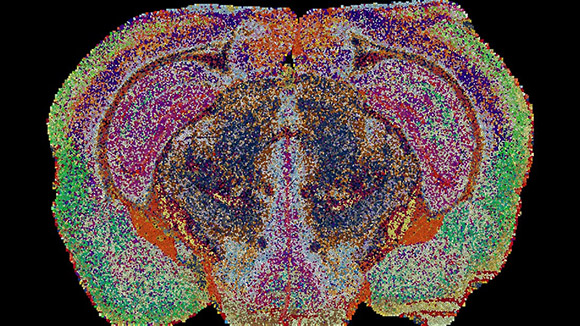 El primer mapa 3D de los lípidos del cerebro de ratón revela cambios inéditos durante el embarazo